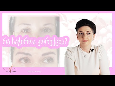 რა საჭიროა კორექცია ? (სასარგებლო რჩევები)